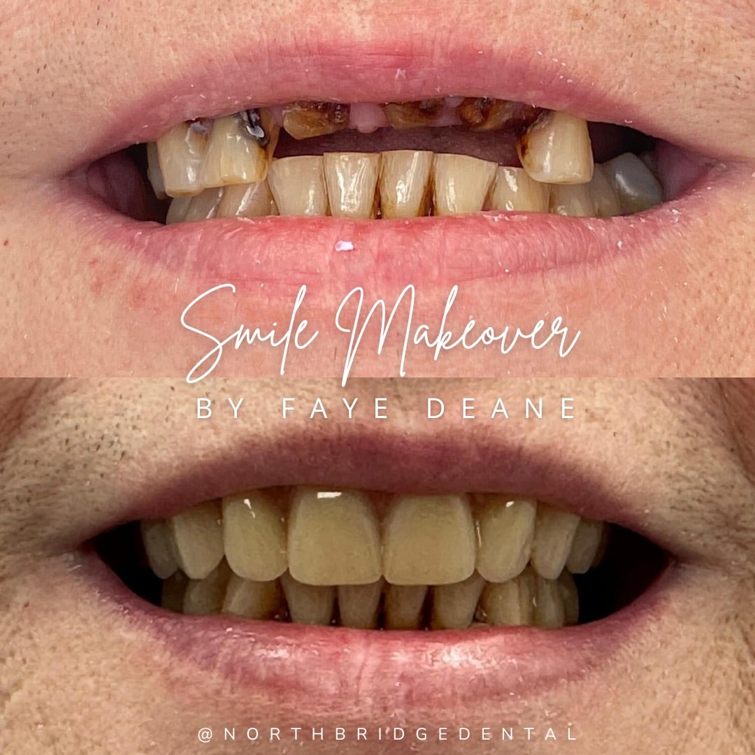 North Bridge Dental Practice Private Dental Practice in Hawick Before and after treatment at North Bridge Dental in Hawick
